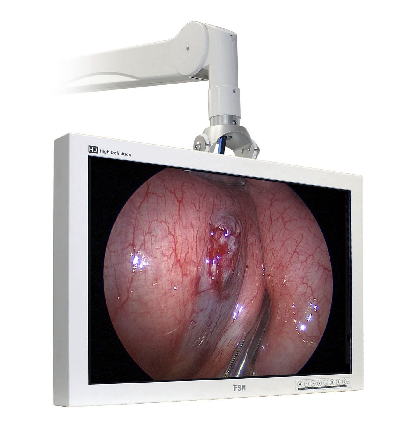 High-definition display / LCD / endoscopy / surgical FS-L2401D FSN Medical Technologies