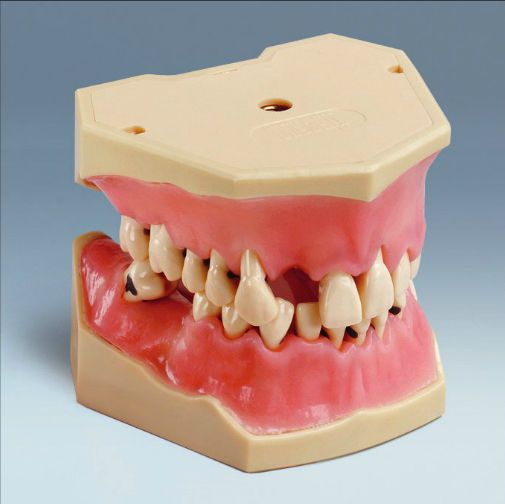 Denture anatomical model A-PB frasaco