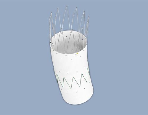 Abdominal stent graft / stainless steel 18 - 22 F ø | Zenith® Renu™ AAA series COOK Medical