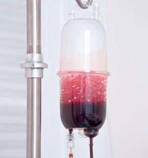 Autohemotherapy infusion set Sangiset® Humares GmbH
