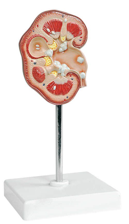 Kidney anatomical model K161 Erler-Zimmer Anatomiemodelle