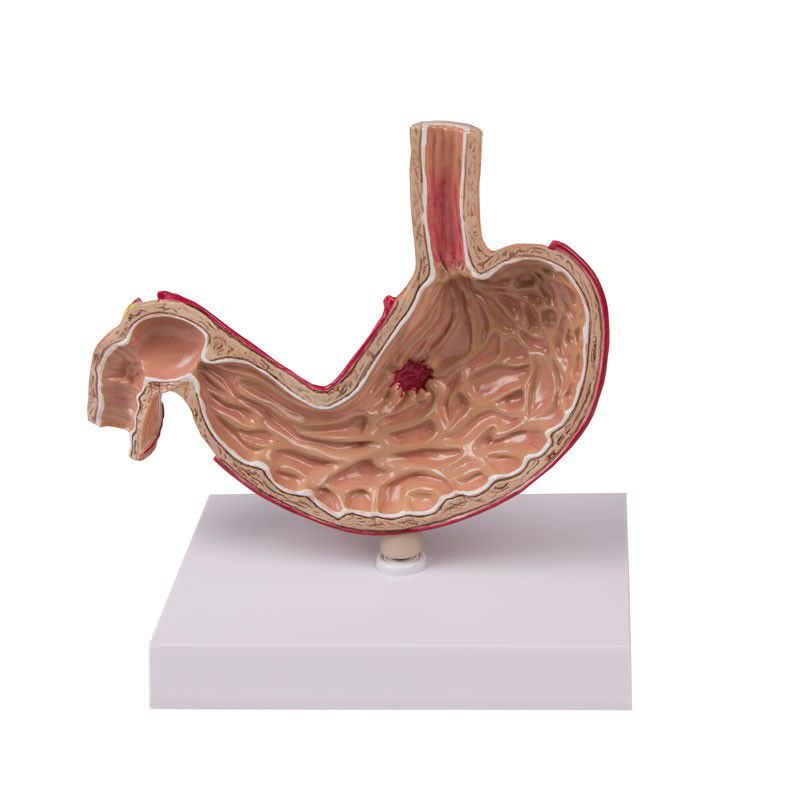 Stomach anatomical model K80 Erler-Zimmer Anatomiemodelle