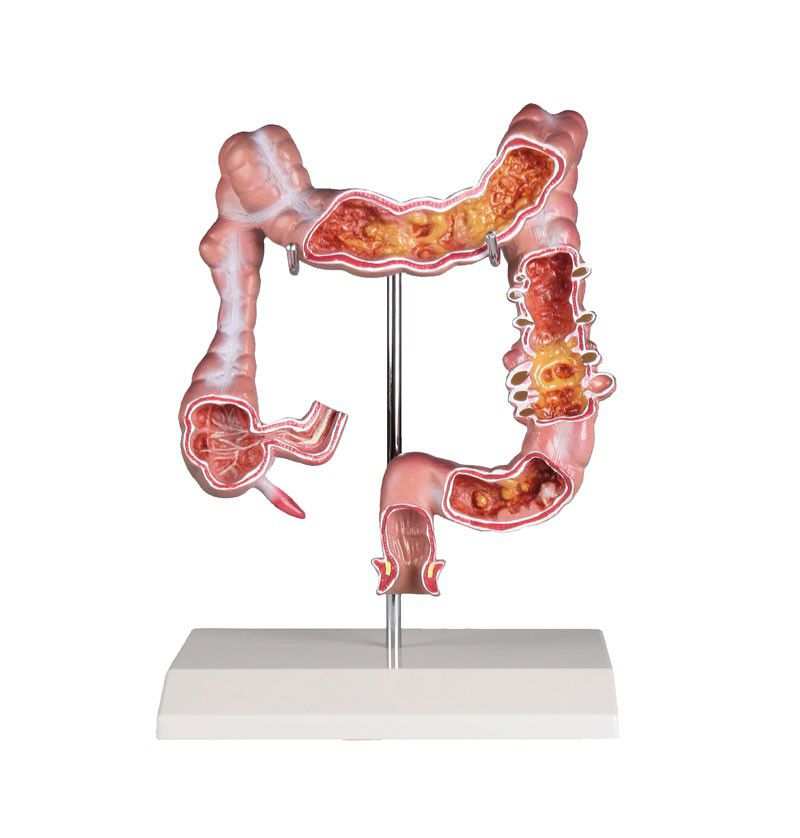 Colon anatomical model K285 Erler-Zimmer Anatomiemodelle