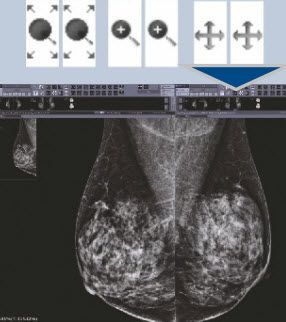 Diagnostic software / viewing / for mammography / medical INFINITT INFINITT NORTH AMERICA