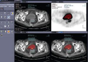 Multimodal image fusion software / medical imaging / medical INFINITT Xelis Fusion INFINITT NORTH AMERICA