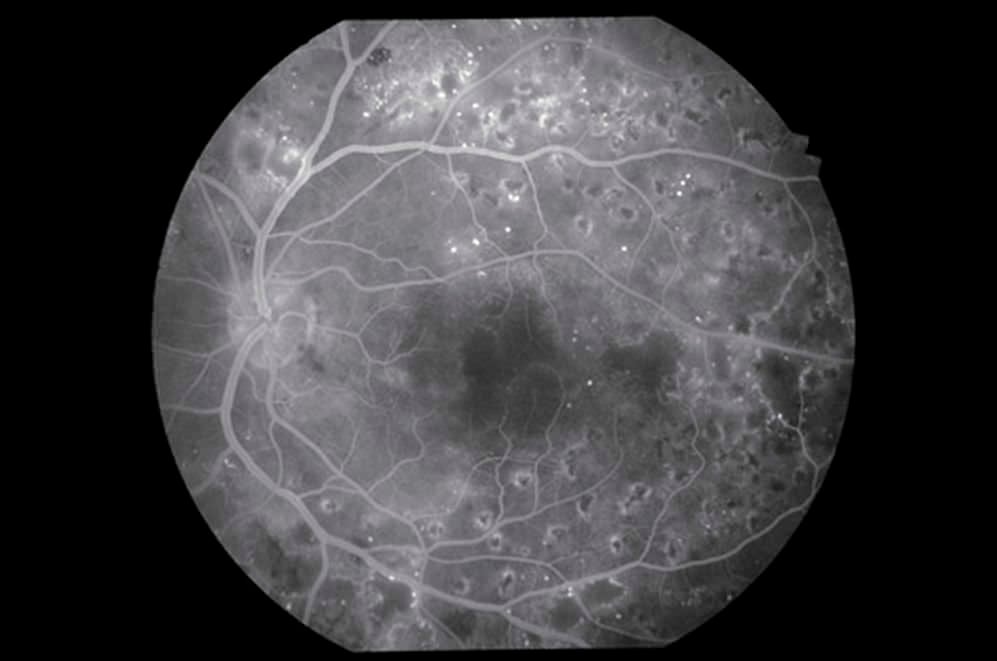 Non-mydriatic retinal camera (ophthalmic examination) / mydriatic retinal camera / eye fluorescein angiography VX-20 Kowa American Corporation