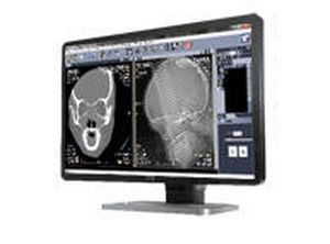 Sharing web application / diagnostic / viewing / acquisition Teleradiology Millensys