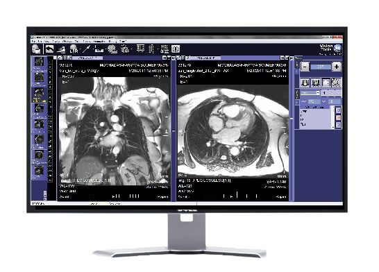 Medical computer workstation / for PACS MultiView Millensys