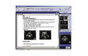 Reporting software / analysis / medical / medical imaging MiReport Millensys