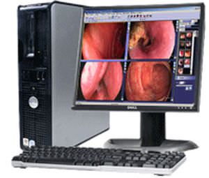 Endoscopy computer workstation / medical Endo Millensys
