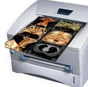 X-ray film printer MiPrint Millensys