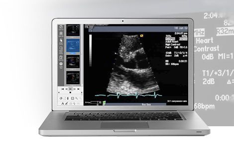 Cardionavigator software