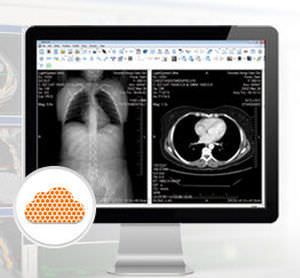Viewing software / management / diagnostic / medical imaging eFilm Workstation® 4.0.1 MERGE Healthcare