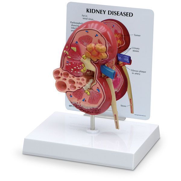 Kidney anatomical model SB46337G Nasco