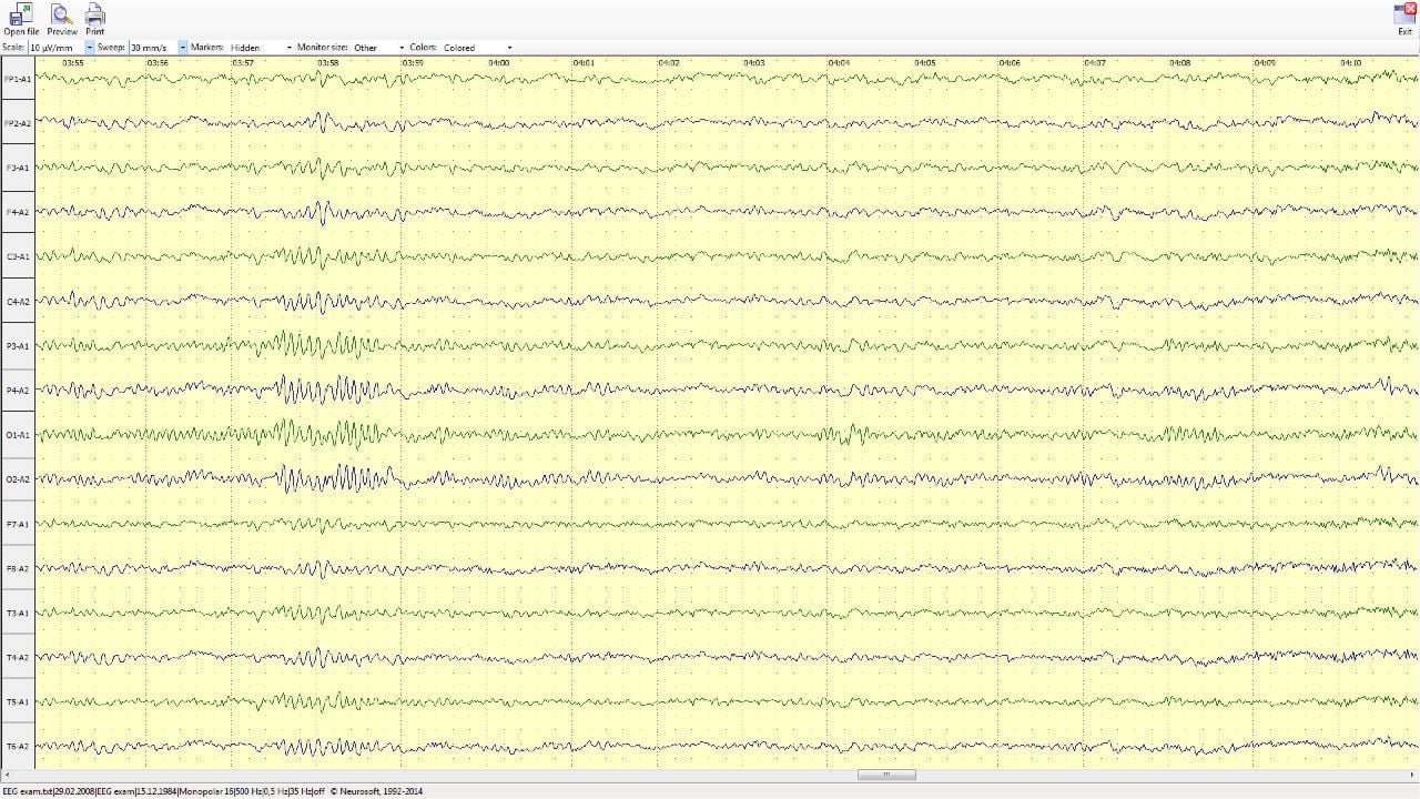 Viewing software / EEG Neuron-Spectrum-Viewer Neurosoft