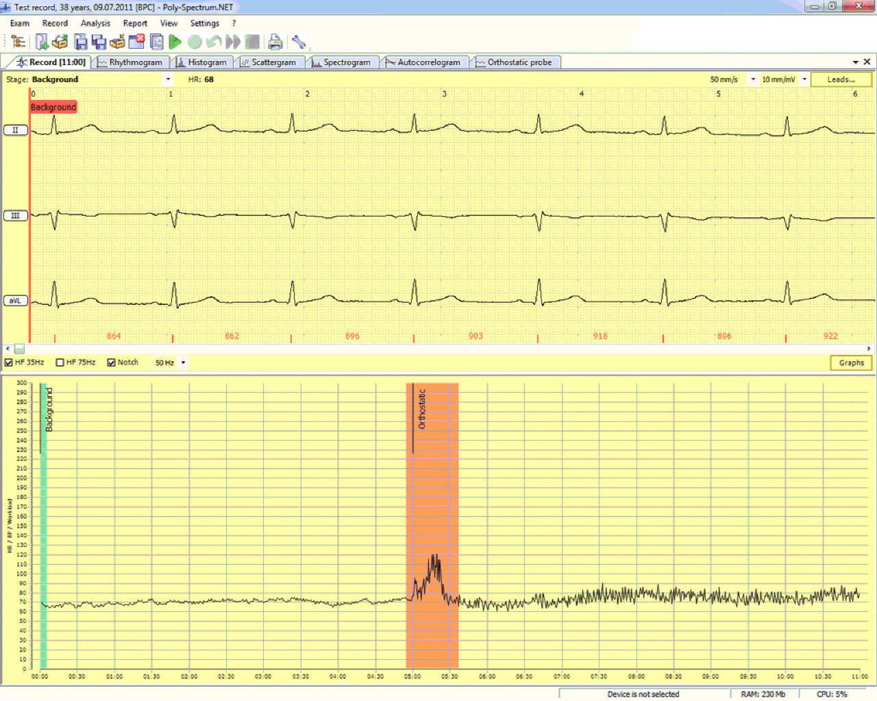 Analysis software / cardiovascular Poly-Spectrum-Rhythm Neurosoft