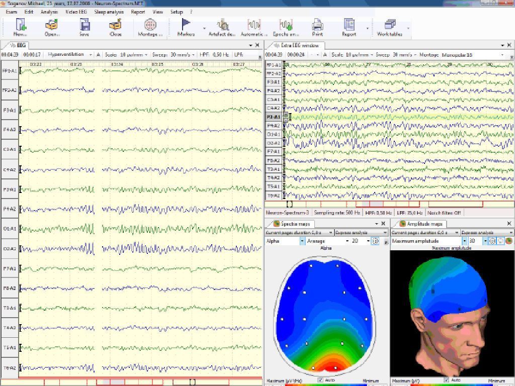 32-channel electroencephalograph Neuron-Spectrum-5 Neurosoft