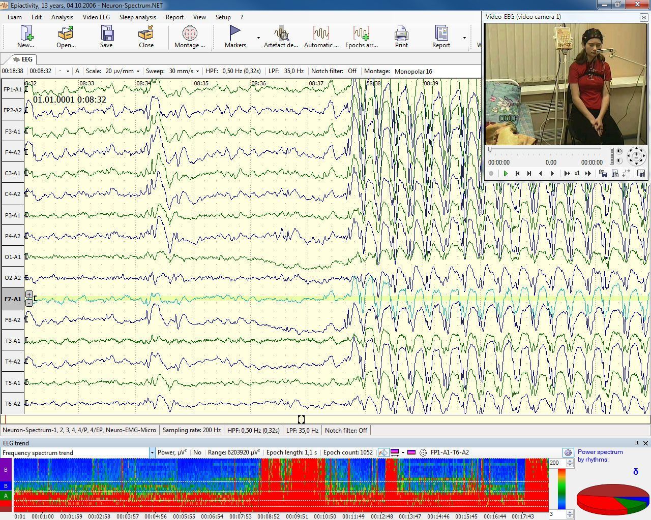 EEG monitoring system Neuron-Spectrum-Video Neurosoft