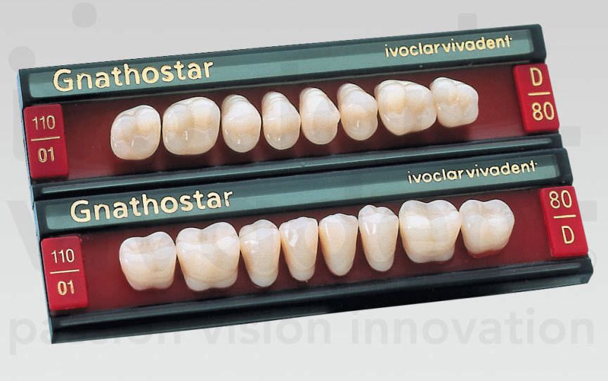 Ceramic dental prosthesis Gnathostar Ivoclar Vivadent