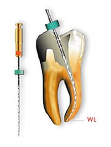 Rotary endodontic file / nickel titanium G-Files™ series Micro-Mega