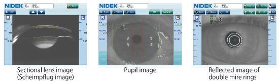 Ophthalmic biometer (ophthalmic examination) / optical biometry AL-Scan NIDEK