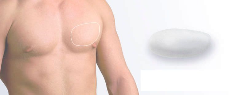 Pectoral cosmetic implant / anatomical / silicone Polytech Health & Aesthetics
