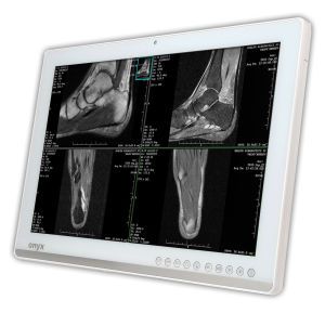 Medical panel PC 24", Quad Core 3.1 GHz | ZEUS-247H Onyx Healthcare Inc