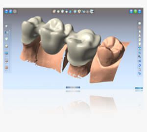 CAD software / 3D viewing / for dental imaging Shining3D-DentCAD Shining 3D