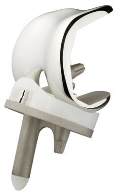 Three-compartment knee prosthesis / mobile-bearing / traditional Rotaglide+™ Corin