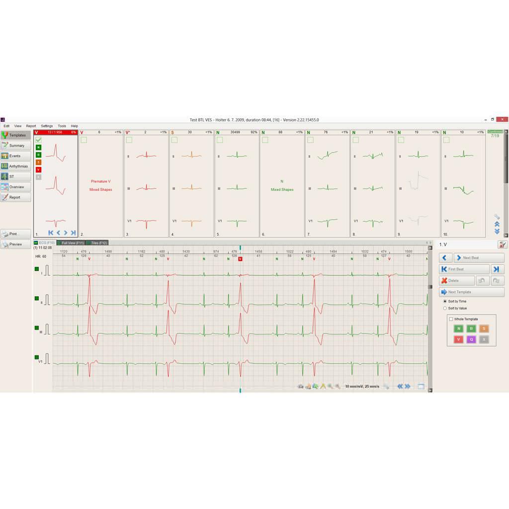 3-channels cardiac Holter monitor BTL CardioPoint-Holter H100 BTL International