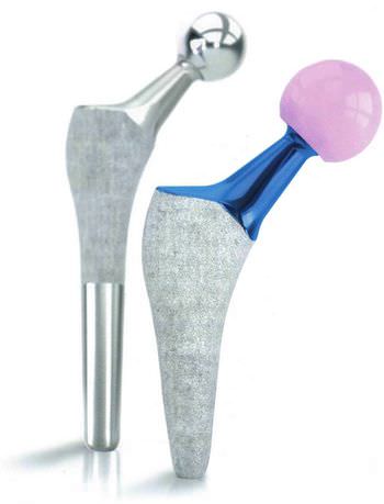 Traditional femoral stem / cementless OPALE XS EVOLUTIS