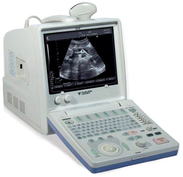 Portable ultrasound system / for multipurpose ultrasound imaging UF-400AX Fukuda Denshi