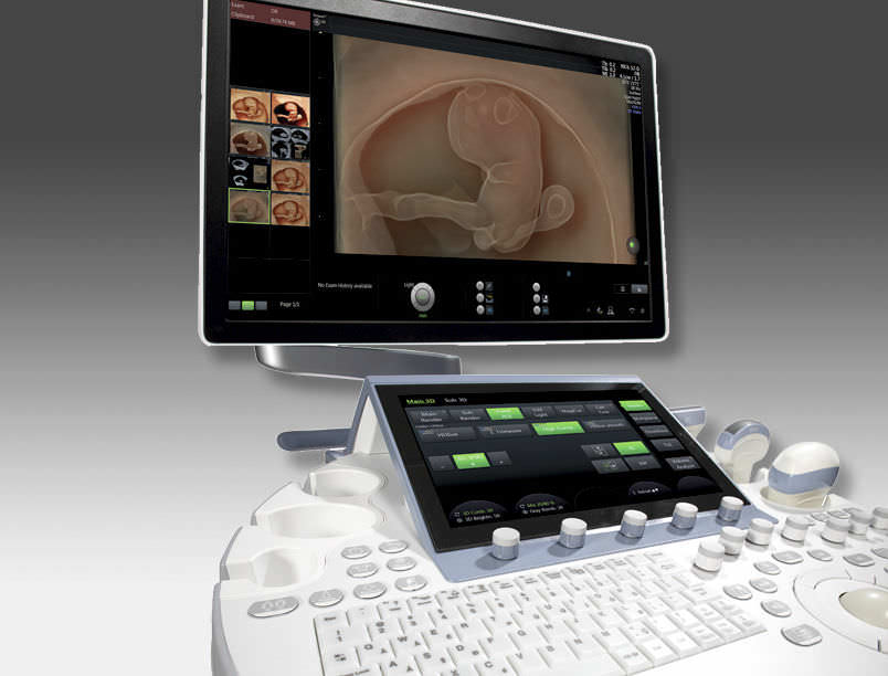 Ultrasound system / on platform / for gynecological and obstetric ultrasound imaging Voluson E10 GE Healthcare
