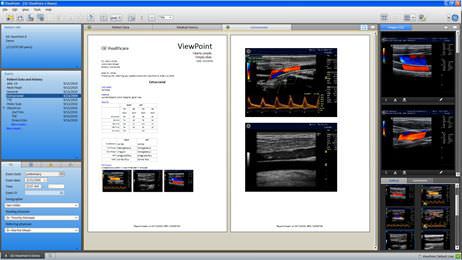 Data management software / medical / for vascular examination / for ultrasound imaging GE Healthcare