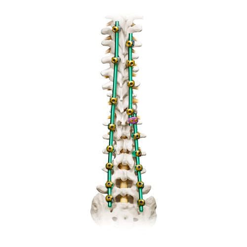 Thoraco-lumbar spinal osteosynthesis unit / posterior PROTEX® Globus Medical