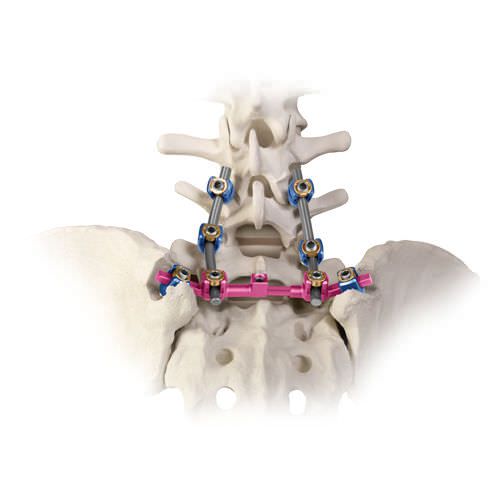 Sacroiliac spinal osteosynthesis unit / posterior REVERE® ADDITION® Globus Medical