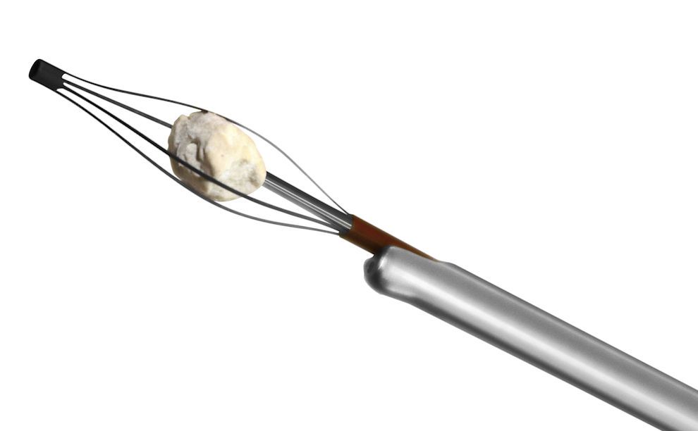 Kidney stone extraction endoscopic basket / straight Lithobasket® Kit EMS Electro Medical Systems