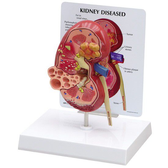 Kidney anatomical model 3260 GPI Anatomicals