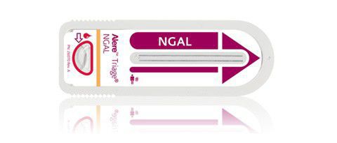 Fluorescence immunoassay rapid test Alere Triage® NGAL Test Alere
