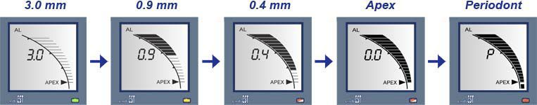 Dental apex locator with pulp vitality testers EndoEst JSC Geosoft Dent