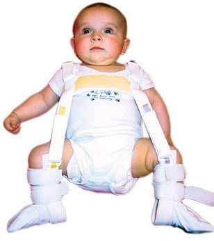 Hip dysplasia orthosis (orthopedic immobilization) / legs abduction / pediatric Össur