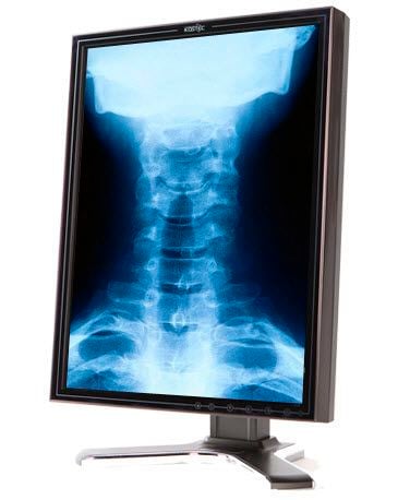 Monochrome display / high-definition / LCD / medical 21.3", 14 bit | Modalion D213Q5E Kostec