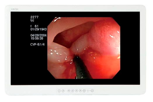 LCD display / high-definition / surgical 27", 2 MP, 14 bit | E270FBE Kostec
