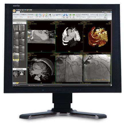 High-definition display / LCD / medical 19", 1 MP, 12 bit | R190S4E Kostec