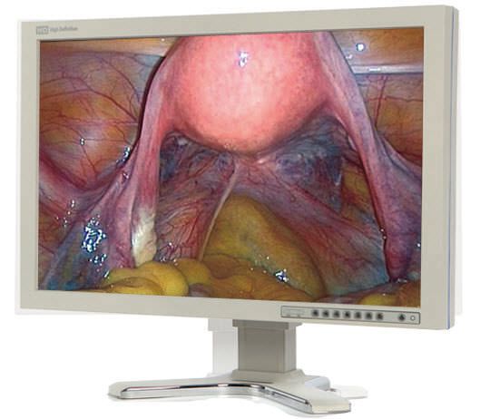 LCD display / high-definition / surgical 24", 2 MP, 12 bit | E240FE Kostec
