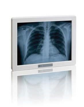 Waterproof medical panel PC / with touchscreen / fanless 10.4" | Medi Client IIA 104 (EOL) Kontron