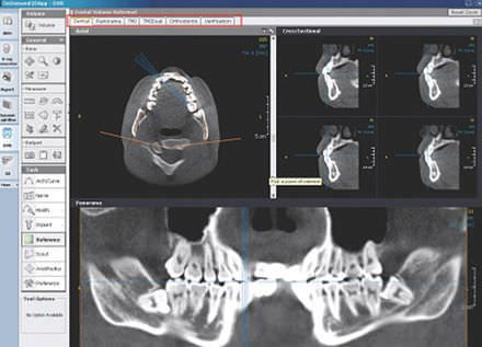 Medical software / for dental imaging OnDemand3D™ Kavo