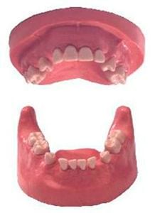 Denture anatomical model / treatment Kavo