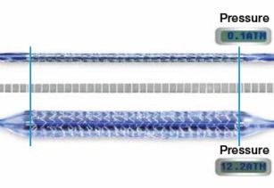 Coronary stent / metal / bare MULTI-LINK VISION Abbott Vascular