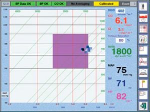 Hemodynamic monitor LiDCOplus LiDCO Hemodynamic monitor LiDCOplus LiDCO